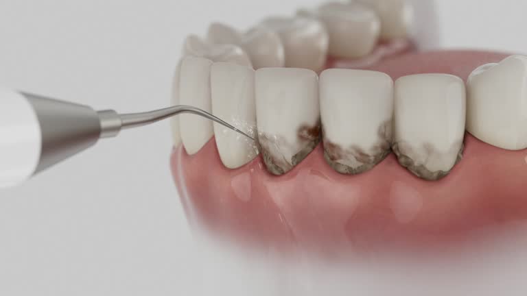 Trusted Dental Crowns And Bridges service in Rossville, IL - Dentist Open Now